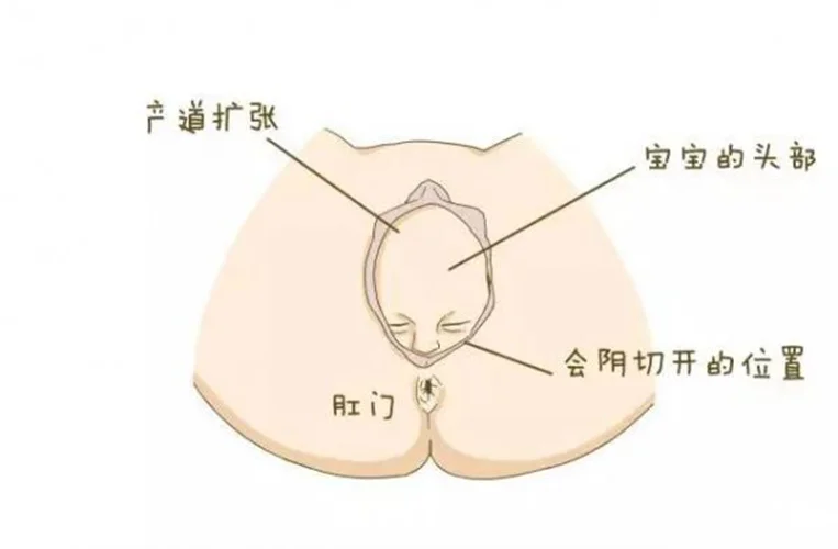 关于顺产、侧切、压肚子,供卵助孕机构地址