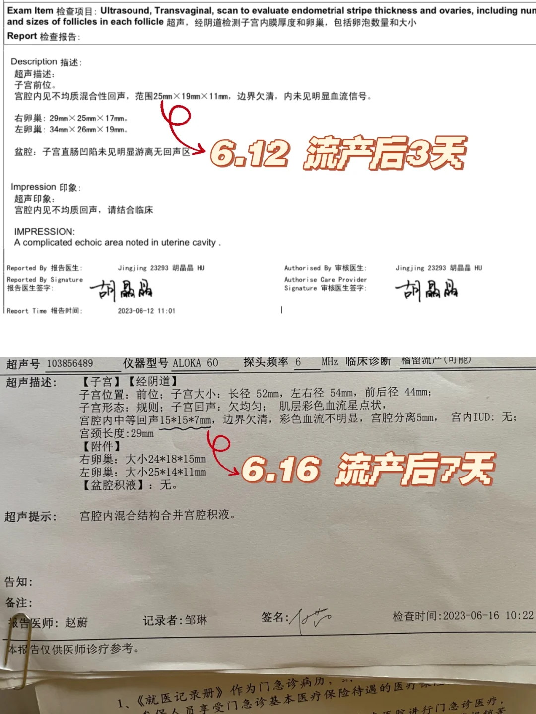 介意慎点！胎停记录2｜自然流产上岸啦,代孕公司案例